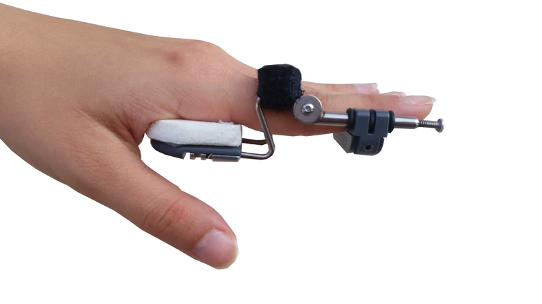 Dynamic Thumb Flexion Splint